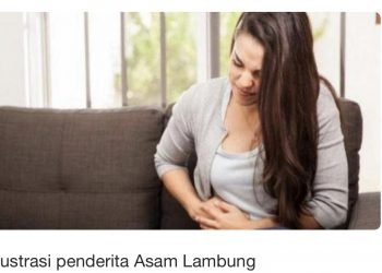 Cara Atasi Asam Lambung Secara Alami